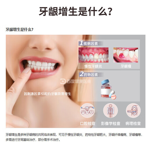 Dr.Avin Gum Hyperplasia Polyp Spray Saileuse Pussy et dentifrice gonflé et graisse pharmacie même, une boîte d'emballage de base
