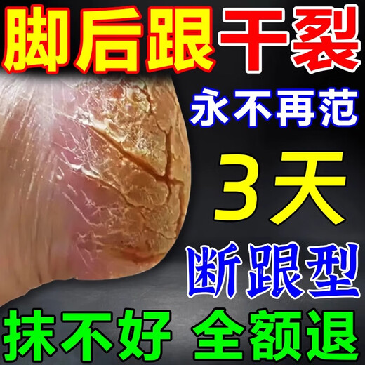 Hong Kong Pharmacy Cracked Heels Cream, Fungal Infection, Cracked and Peeling Feet, Anti-cracking, Moisturizing and Moisturizing Foot Cream w1, buy two and get one free, guaranteed to heal and prevent hair loss.