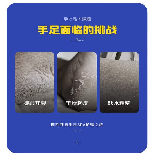 RIBENDINGDING RIBENDINGDING Anti-Trockene Risscreme für Hände und Füße, Fersenrisse und Frostcreme, Fußschutzcreme, Risscreme 50 g, 50 g, 3 Flaschen Frostschutzcreme