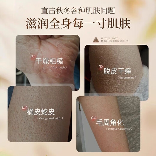 Baiyunshan anti-itch moisturizing lotion whole body moisturizing cream for dry, itchy and peeling skin, hydrating and peeling, moisturizing and moisturizing, full size 200g, fake one, ten penalty, anti-itch moisturizing lotion * 1 bottle, trial pack