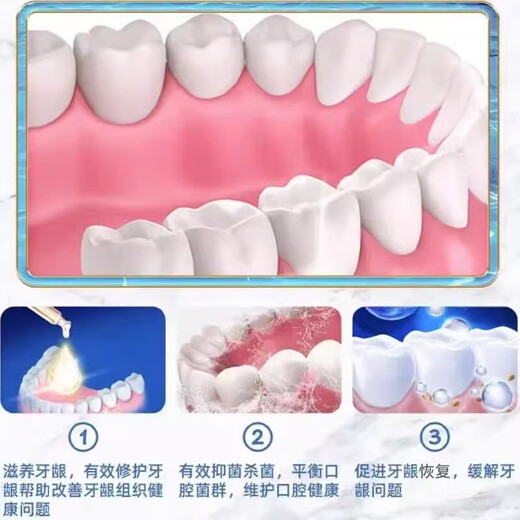 Dr.Avin Gum Hyperplasia Polyp Spray Saileuse Pussy et dentifrice gonflé et graisse pharmacie même, une boîte d'emballage de base