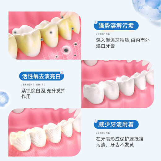 Cailiko tooth patch whitening teeth yellow teeth black teeth tea stains black white 5D white tooth film patch available for men and women. Buy three Song Erfa 5 boxes