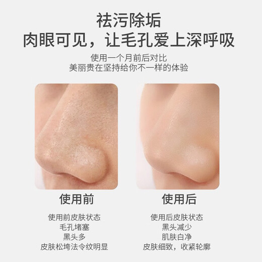 Eugenics Love Dou Ultrasonic Ion Skin Beautifier Skin Scraping Instrument Cleans Dead Facial Skin Removes Blackheads and Scrapes Acne Sonic Cleaning Export Import Skin Scraping Machine Pink Blue