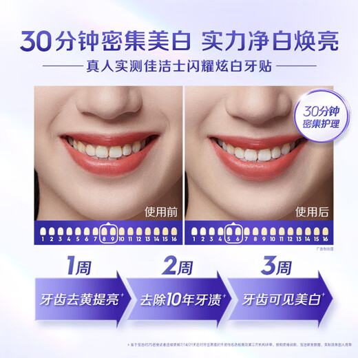 Crest Shiny White Teeth Strips 10 pairs of 20 pieces to remove yellowing, remove stains and prevent stains, easily beautiful teeth, new and old packaging shipped randomly