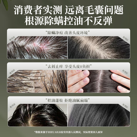 HIEUAILR德国品牌毛囊清洁洗发水去屑止痒控油蓬松除螨男女士持久留香洗膏 【一瓶见效装】净澈控油止痒去屑