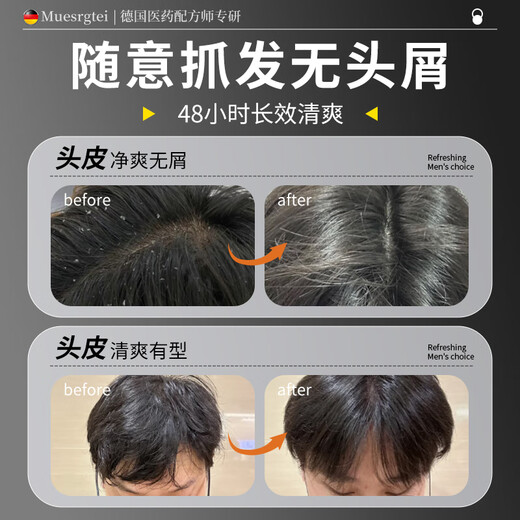 MUESRGTEI胖东来洗发水男士专用控油去屑止痒蓬松持久留香毛囊清洁洗发液