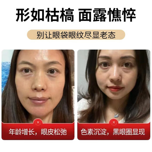 仁和匠心抗皱眼霜淡化细纹提拉紧致眼部男女士黑眼圈补水保湿眼袋精华霜 【抗皱淡纹眼霜30g】拍2件划算