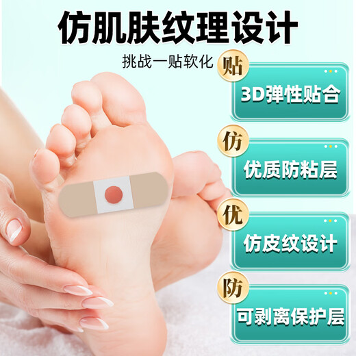 Yunnan herbal corn patch corn ointment to remove thorns on the roots of the feet, painless removal of flat warts, calluses on hands and feet, soles and toes warts