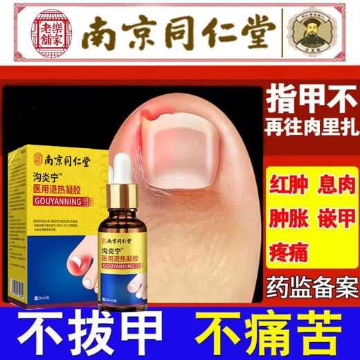 Nanjing Tongrentang specializes in treating paronychia, special treatment for ingrown toenails, redness, swelling and pain, granulation and polyp removal, swelling and suppuration, deep foot care 1 box Tongrentang