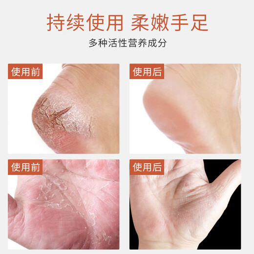 Supreme Banana Cream Thai Anti-Crack Foot Cream Foot Cream Cracked Heels Cracked Hands and Feet Moisturizing Crown Brand 120g 1 Box (6 Bottles) Banana Cream Original Import