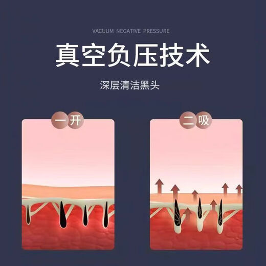 Qiji Blackhead Cleaning Magic Powerful Suction Beauty Salon Special Suction Instrument Nose Remover Acne Electric Facial Cleansing Instrument Beauty Basic Version 6 Suction Heads + Blackhead Remover