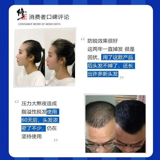 Repair the Great Father’s Anti-Solid Decontamination Liquid Shampoo Hair Loss Hair Loss Hair Solid Decontamination Liquid Moisturizes the roots and scalp follicles Anti-Solid Decontamination Liquid Installs 3 pieces in a periodic manner