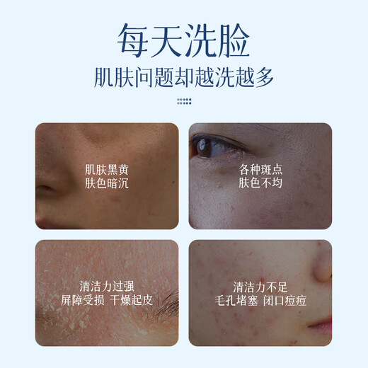 YERENTANG imported amino acid whitening facial cleanser, freckle removal, mite removal, acne oil control, moisturizing and brightening facial cleanser for men and women, whole body whitening facial cleanser + whitening shower gel