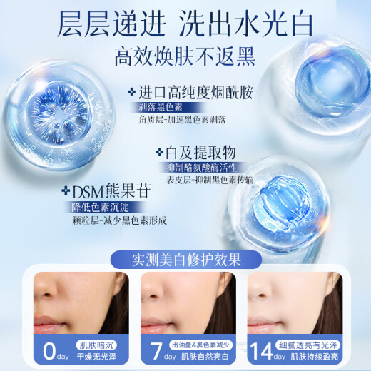 Vetes (Vetes) Aminosäure Gesichtsreiniger für Männer und Frauen, die Flecken aufweichen und Flecken aufhellen, die Hautton -Kontrolle Ölreinigungsporen und Akneentfernung Blackhead Cleanser [KO dunkelgelbfleckige Haut] Aufhellenreiniger 300 g