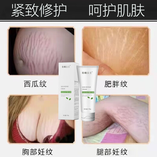 Pink Princess Pregnancy Cream, Pregnancy Marks, Pregnant Women's Growth and Obesity, Special Textile Care Oil, Postpartum Repair, Prevention, Fading, Necessary Pregnancy Supplies, One Bottle of Pregnancy Marks Repair Cream