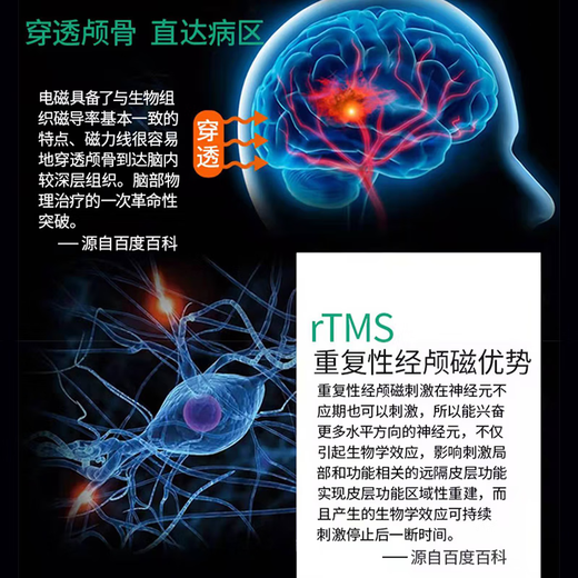 Dispositivo de terapia de estimulación magnética transcraneal para accidente cerebrovascular infarto de accidente