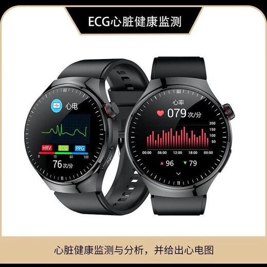 2025 new Xiaomi mobile phone universal non-invasive monitoring of blood sugar, heart rate, blood pressure, uric acid, sleep smart health watch black - top version of blood sugar, blood pressure, blood lipid watch
