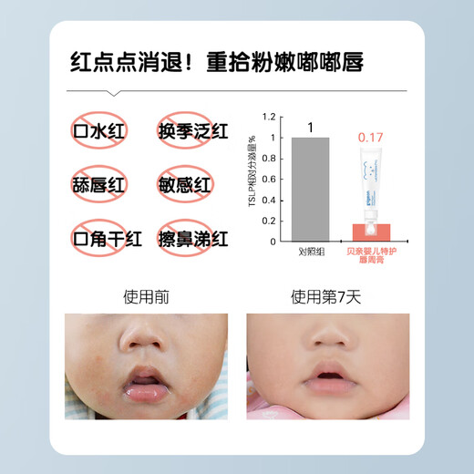贝亲（Pigeon）婴儿特护唇周膏 宝宝口水护理膏滋润疹保护 12g IA290