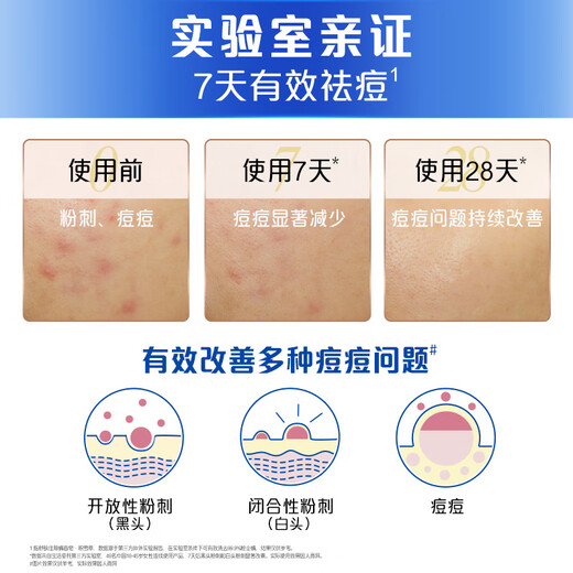 Shufujia anti-acne soap white tea 108g contains salicylic acid, oil-removing refreshing soap, bath and face wash, universal for men and women