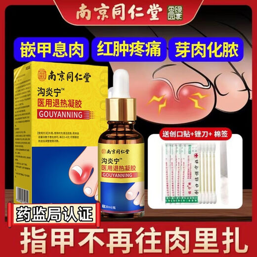 Nanjing Tongrentang specializes in treating paronychia, special treatment for ingrown toenails, redness, swelling and pain, granulation and polyp removal, swelling and suppuration, deep foot care 1 box Tongrentang