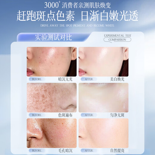 Die Vitex-Gesichtsmaske ist feuchtigkeitsspendend, feuchtigkeitsspendend, aufhellend, entfernt Blässe und Mattheit, hellt den Hautton auf, wirkt gegen Falten, strafft, beugt Alterung und Sommersprossen vor, für Männer und Frauen, festigt die Aufhellung, 4 Packungen mit 40 Tabletten