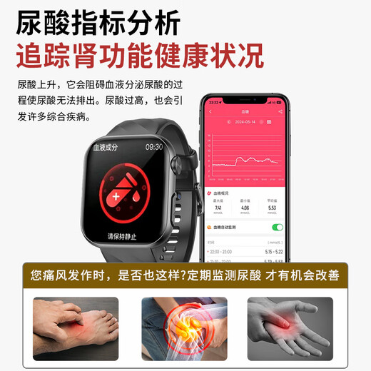 FUKR华为机适用高精准无创血糖血压监测手表测血脂尿酸血氧心率动态免扎针仪器智能健康一体机运动手环 月光银【无创血糖血压监测+NFC门禁离线支付】