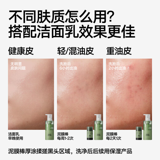 Reasonably and effectively clean blackheads and remove mud mask rod cleaning mask azelaic acid exfoliation 45g Chinese Valentine's Day gift