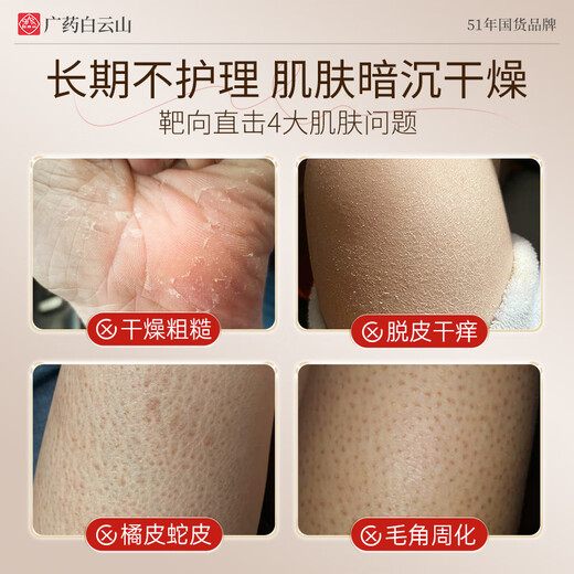 Baiyunshan anti-itch moisturizing lotion for dry, peeling and peeling skin, moisturizing and moisturizing body lotion for whole body use 200ml