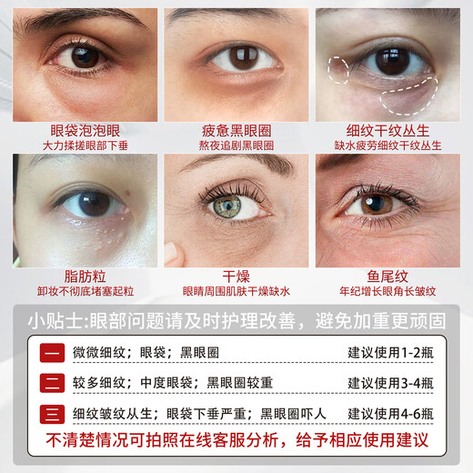 达里博士  DR.DARRY眼霜淡化细纹提拉紧致黑眼圈抗熬夜衰老眼霜抗皱补水眼袋七夕礼物