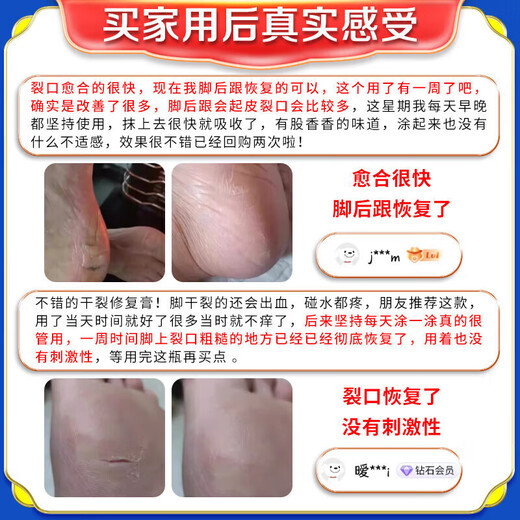 Hong Kong Pharmacy Cracked Heels Cream, Fungal Infection, Cracked and Peeling Feet, Anti-cracking, Moisturizing and Moisturizing Foot Cream w1, buy two and get one free, guaranteed to heal and prevent hair loss.