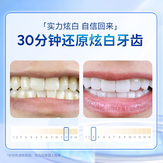 SMILEKIT Whitening Teeth Strips, Teeth Whitening Remove Yellow, Whiten and Brighten Teeth Stains, Remove Stains, Portable Sparkling White Teeth Whitening Strips, 1 box trial pack [7 pairs of 14 patches]