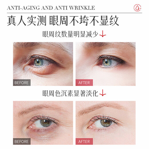 Nanjing Tongrentang Anti-Wrinkle Eye Cream Fattening Fine Lines Dark Eye Bags Fat Grain Lifting and Firming Anti-Wrinkle Women's Day Gift 50g