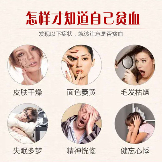 【药店同款】玛丽安娜黄芪阿胶补血口服液改善营养性贫血孕妇产后成人气血两虚补铁口服液 【推荐】黄芪阿胶口服液10盒