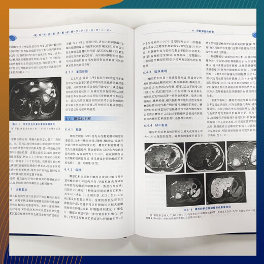 Diagnóstico de resonancia magnética del cuerpo moderno [nuevo y genuino]: hígado, vesícula biliar, pancreática, volumen del bazo Zhou Kangrong, Yan Fuhua, Liu Shiyuan 97873091 ** 701 Fudan University Press