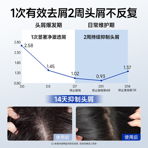尊蓝1%二硫化硒去屑洗发水200g去屑止痒控油蓬松头皮清爽洗发露男女士