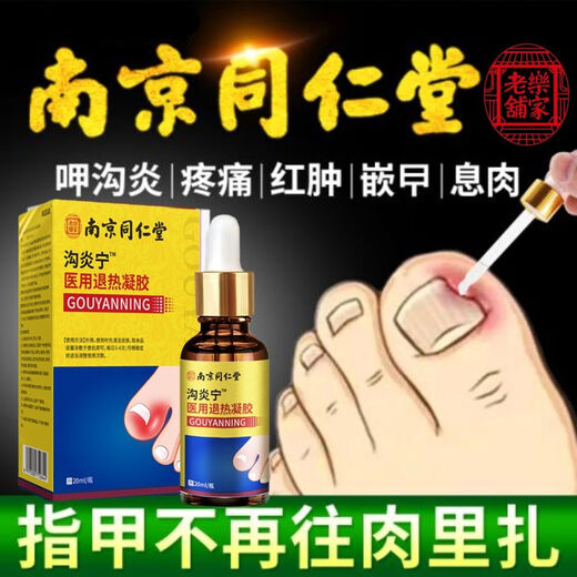 Nanjing Tongrentang specializes in treating paronychia, special treatment for ingrown toenails, redness, swelling and pain, granulation and polyp removal, swelling and suppuration, deep foot care 1 box Tongrentang