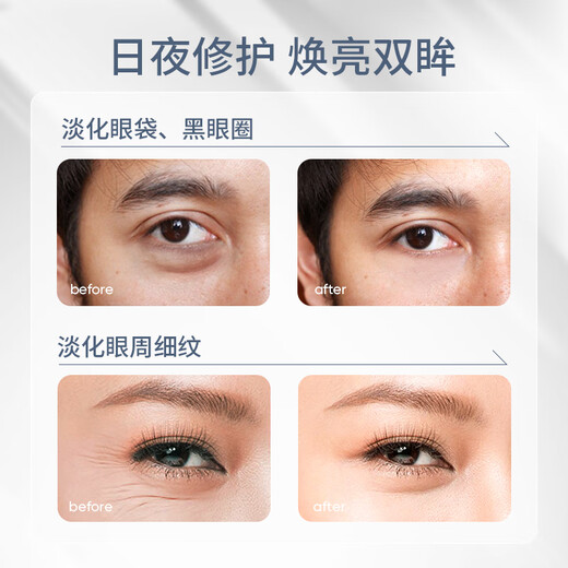 SUMDOY Japanese imported eye cream improves dark circles, eye bags, lightens fine lines, lifts and tightens men and women [Super value recommendation] Eye cream + eye mask Double repair