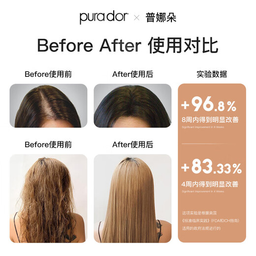 Purador Purador Anti-zerstruktes Haarwachstum Shampoo 473ml Roségold Haare haarthaarige Kopfhaut Shampoo aus den USA importiert