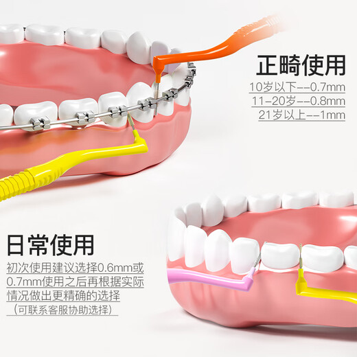 Nikiso Japan imported interdental brush 10 pieces interdental brush orthodontic correction teeth special L-shaped toothbrush 0.6mm 10 pieces 1 bag imported from Japan