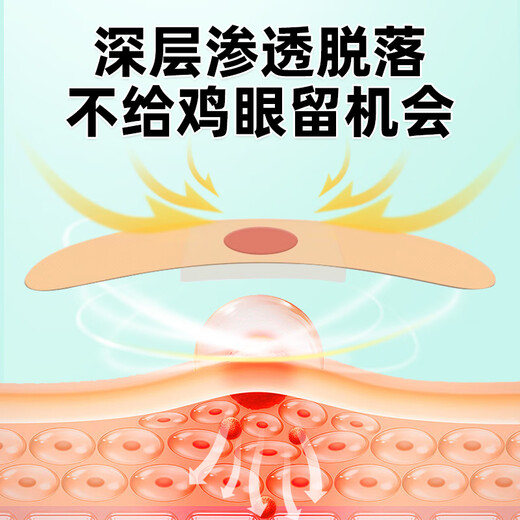 Yunnan herbal corn patch corn ointment to remove thorns on the roots of the feet, painless removal of flat warts, calluses on hands and feet, soles and toes warts