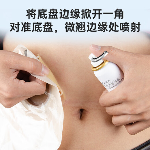 Enfermera compañera de clase Ostomy Pocket Chassis Adhesivo Spray Spray Medical Viscose Remover Stoma Care Products Remover Viscose [50 ml/botella] Remover adhesivo de chasis 12010