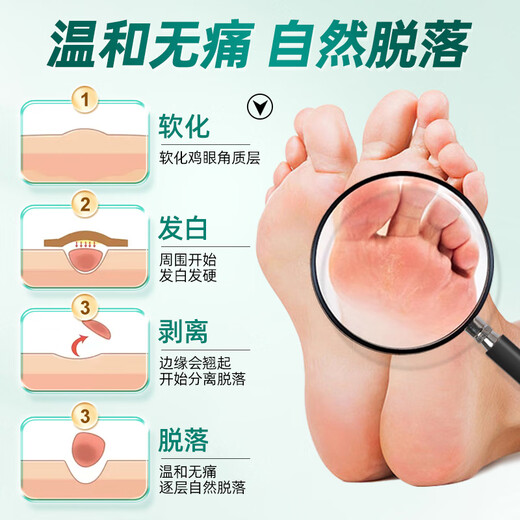 Yunnan herbal corn patch corn ointment to remove thorns on the roots of the feet, painless removal of flat warts, calluses on hands and feet, soles and toes warts