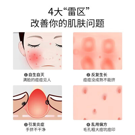 Kelai Zaotang Acne Needle Set Closed Mouth Shaving Blackhead Acne Needle Picking Acne Acne Removal Needle Squeezing Tool Acne Needle 1 Piece