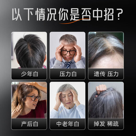 MOSLATE German imported targeted black hair capsule 7.0 Germany original imported bio-grade hair management for men and women 7 boxes of consolidation [no hair dyeing ever since]
