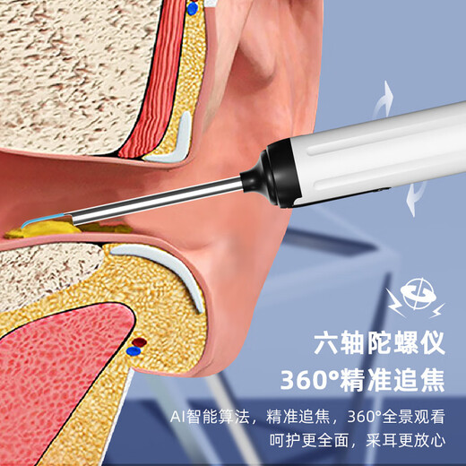 Shantou Lincun cross-border high-definition WIFI smart cleaning artifact wireless multi-functional ear scoop home practical visual ear scoop V11 black por