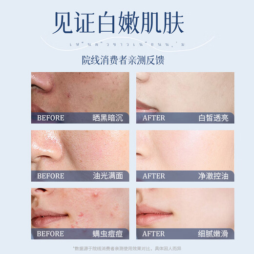 YERENTANG imported amino acid whitening facial cleanser, freckle removal, mite removal, acne oil control, moisturizing and brightening facial cleanser for men and women, whole body whitening facial cleanser + whitening shower gel