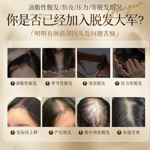 南京同仁堂防脱育发洗发水生姜头发增防脱发控油蓬松草本老姜王固发养发500g