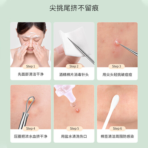 XIAO TIAN LAI ultra-sharp cell clip, acne needle tweezers, blackhead needle, acne needle, acne needle, beauty salon acne removal tool, unisex, dark green tip clip + acne needle 4-piece set, 1 piece