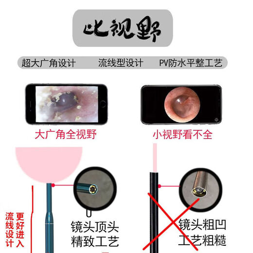 Humanuntersuchung Endoskopkamera Lens Mobiltelefon externer elektronischer Lupe Ultra High Definition visuell Endoskop Ultra Definition Multifunktionale Version (9925 gekaufte Personen) Android