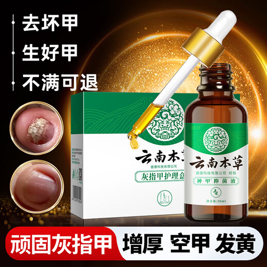 Chunchuntang Yunnan Herbal Onychomycosis Special Effect Chinese Herbal Antibacterial Liquid Thickening and Yellowing Hollow Onychomycosis Care Box